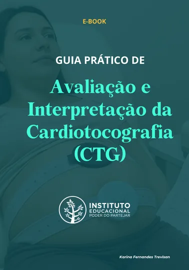 Guia Prático de Avaliação e Interpretação da Cardiotocografia (CTG)