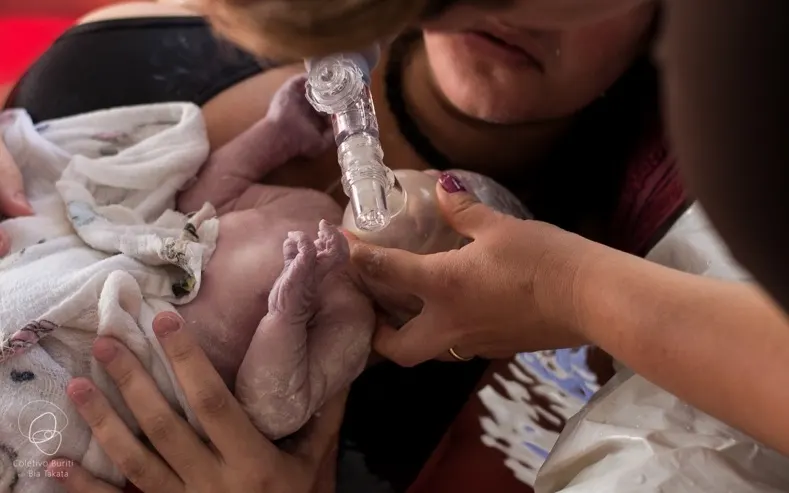 Recém-nascido recebendo ventilação com máscara nos primeiros minutos de vida